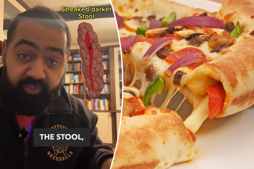 Doctor's 'pizza topping' trick to tell the difference between hemorrhoids and a sign of colon cancer